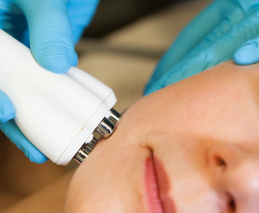 Contour behandeling met Refit